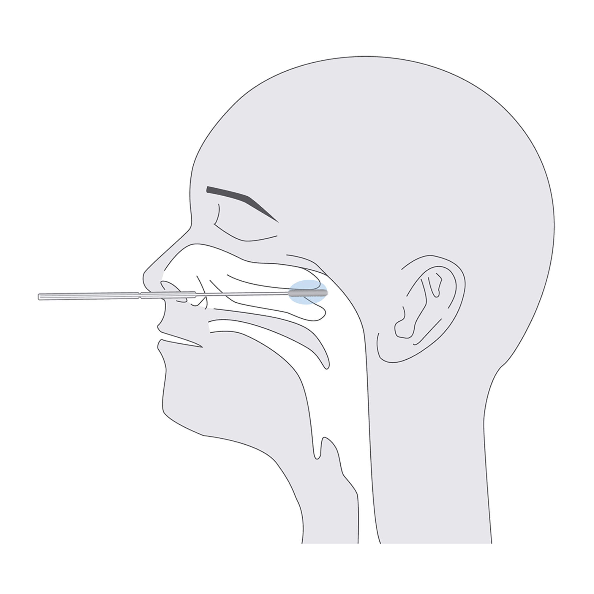SARS-CoV-2 Rapid Antigen-Test Nasen-Rachen