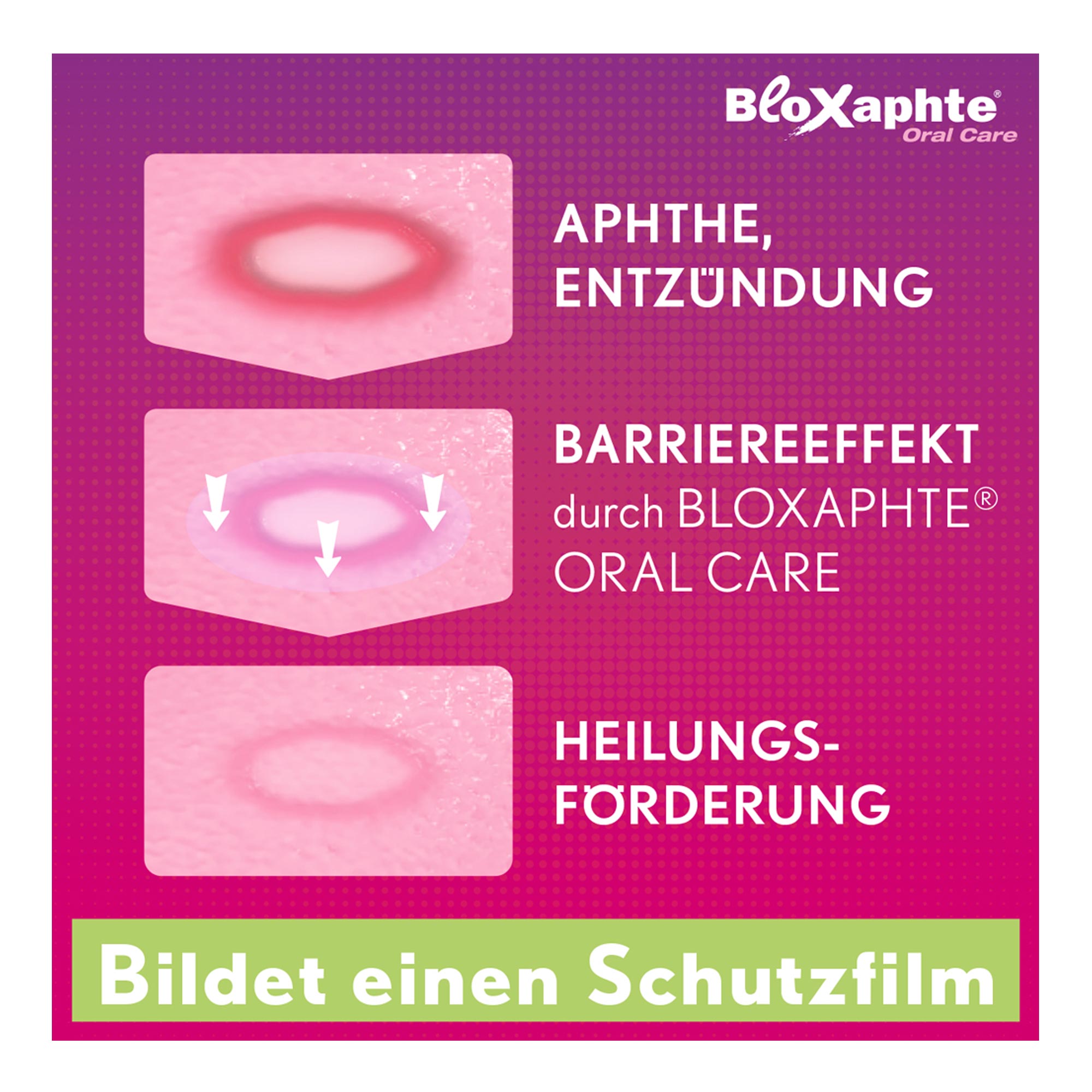 Bloxaphte Oral Care Mundspülung Wirkweise