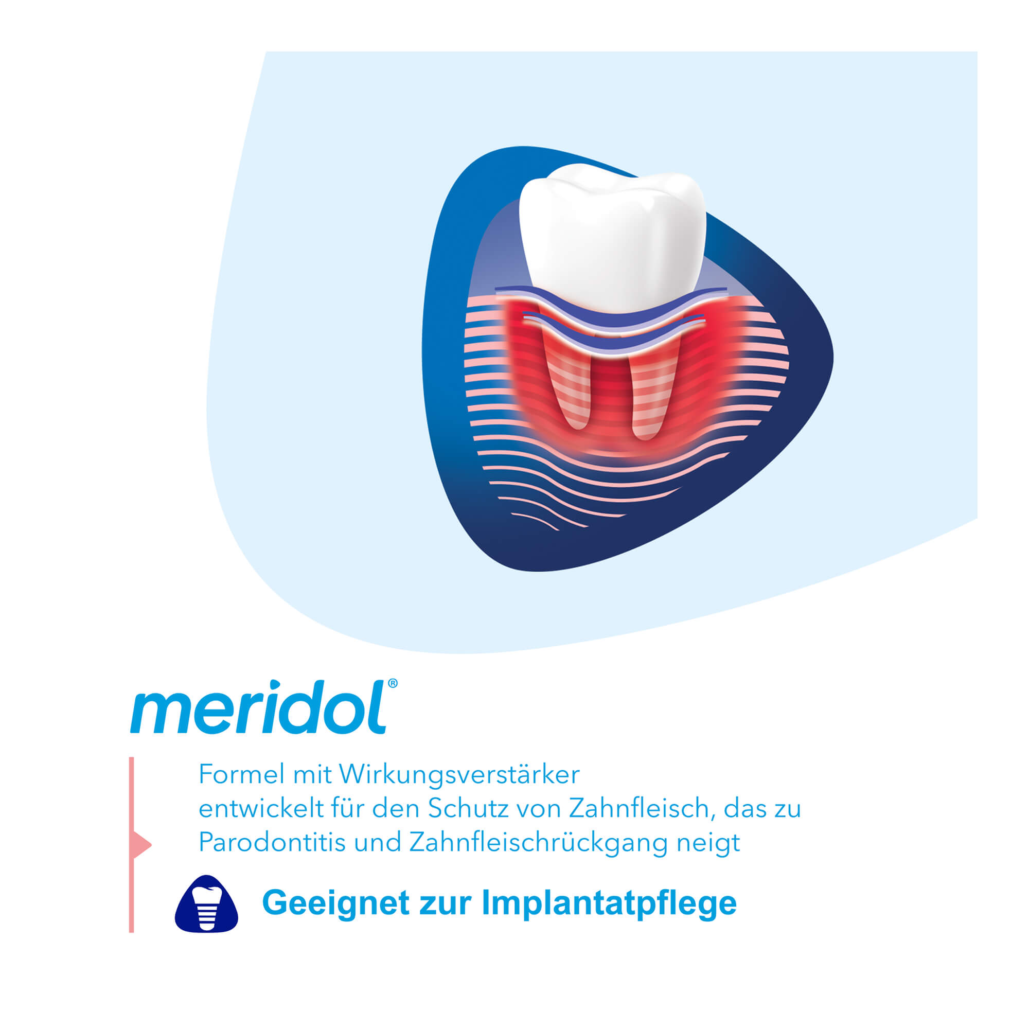 Grafik Meridol Parodont Expert für Implantate geeignet