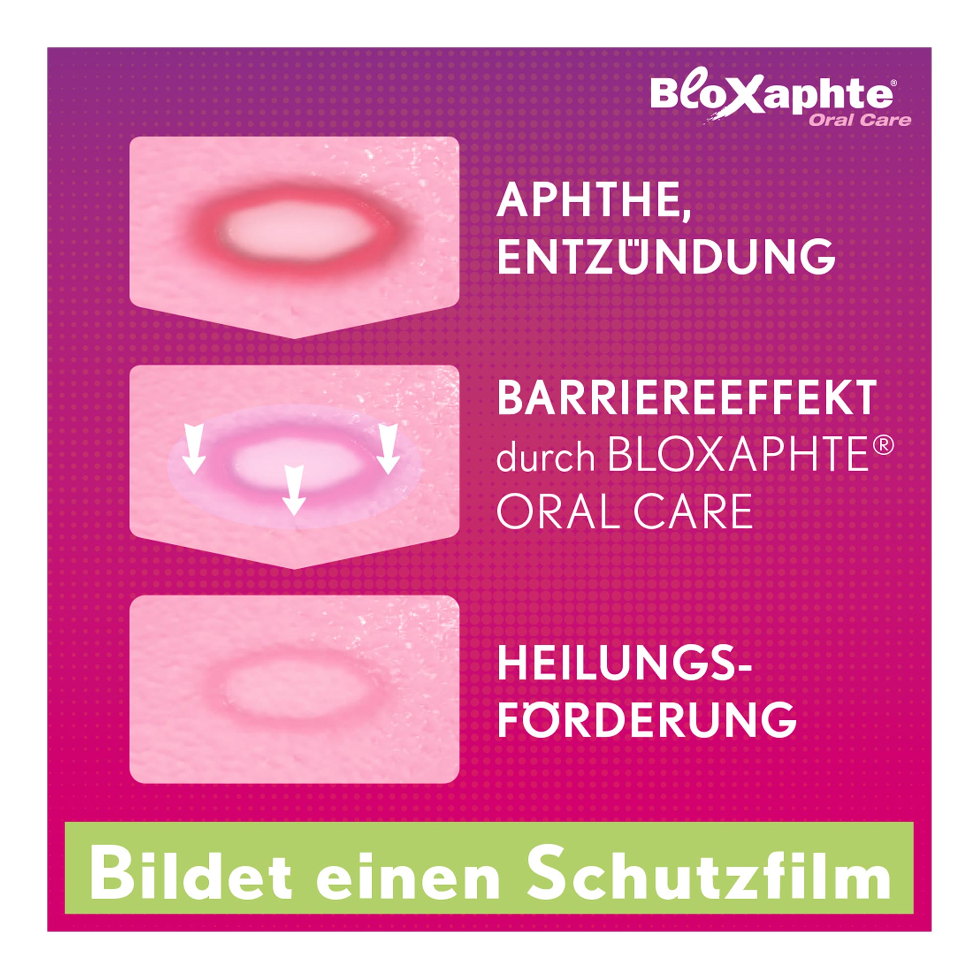 Bloxaphte Oral Care Mundgel Wirkungsweise